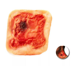 Fausse cicatrice rougeâtre adulte