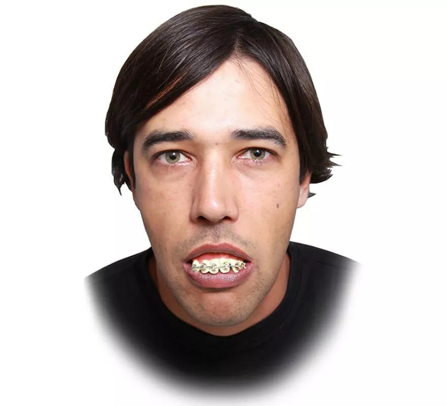 Translation missing: fr.Dentadura con Brakets