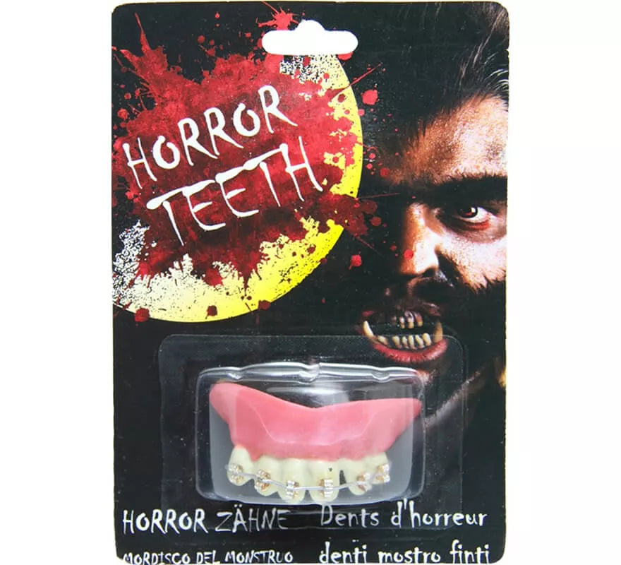 Translation missing: fr.Dentadura con Brakets