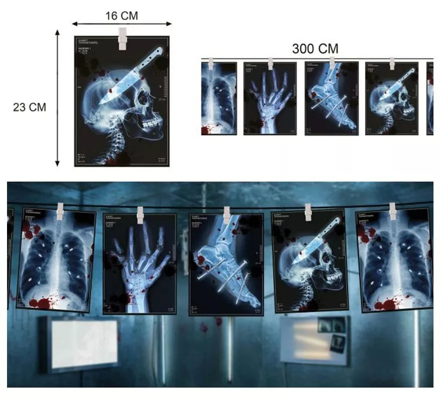 Translation missing: fr.Guirnalda Radiografías de 300 cm